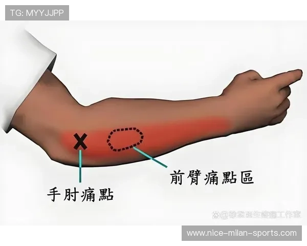 网球肘:不只是网球运动员会得,网球肘会严重吗 网球肘:不只是网球运动员会得,网球肘会严重吗